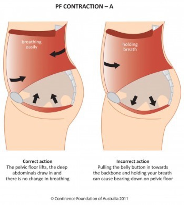 Abdominal Bracing - My Rehab Connection